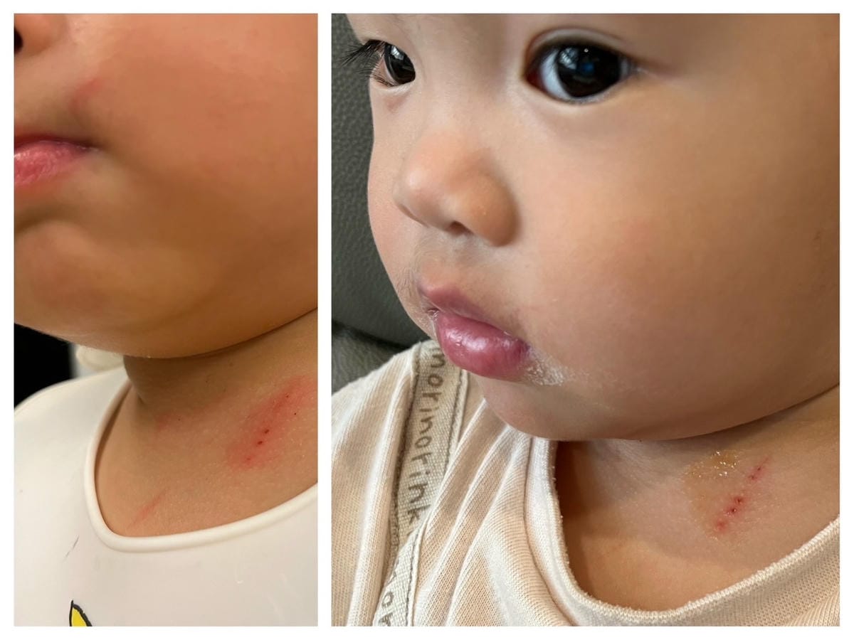 [育] 嬰幼兒萬用膏 – 馨朵拉CINDORA 紫馨膏 媽媽