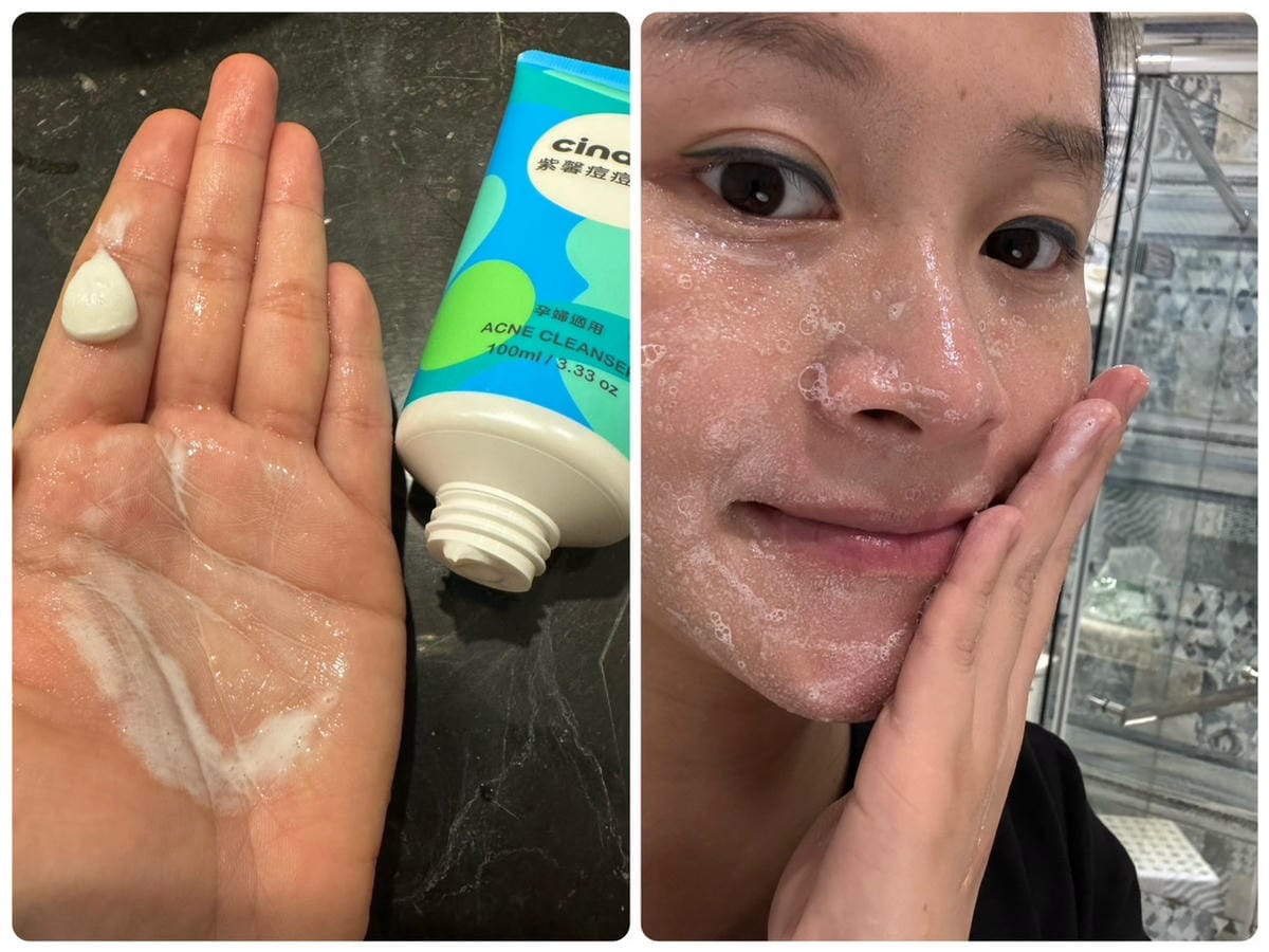 [美] 孕婦適用 不含酸、不含藥 – Cindora 紫馨痘
