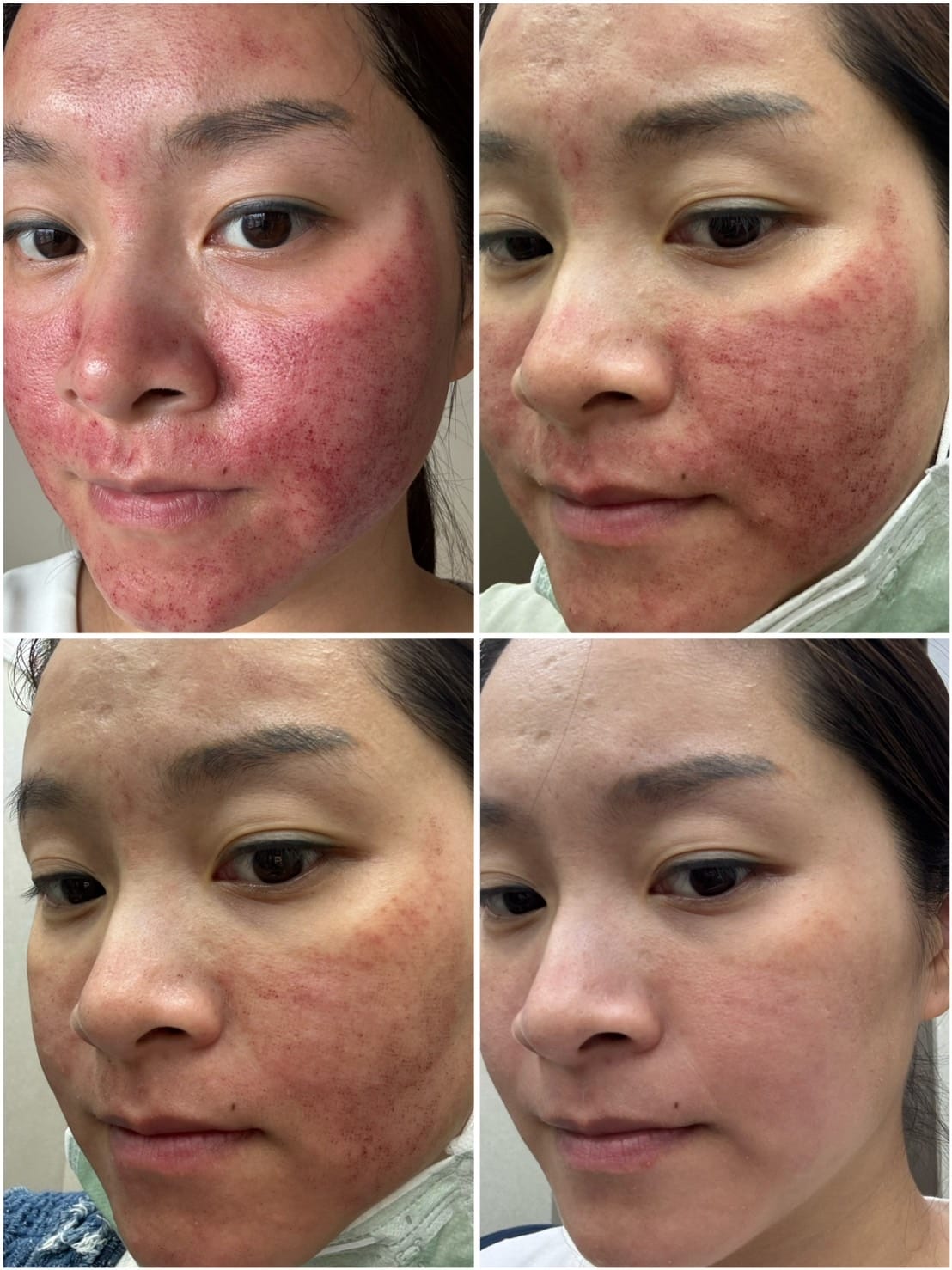[美] 健保看診、醫學美容療程推薦 - 新北板橋 研知診所 