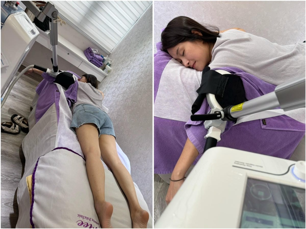 [美] 台北體雕推薦 產後恢復救星 - 愛爾麗診所 力美肌塑