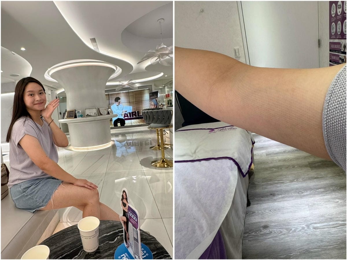 [美] 台北體雕推薦 產後恢復救星 - 愛爾麗診所 力美肌塑
