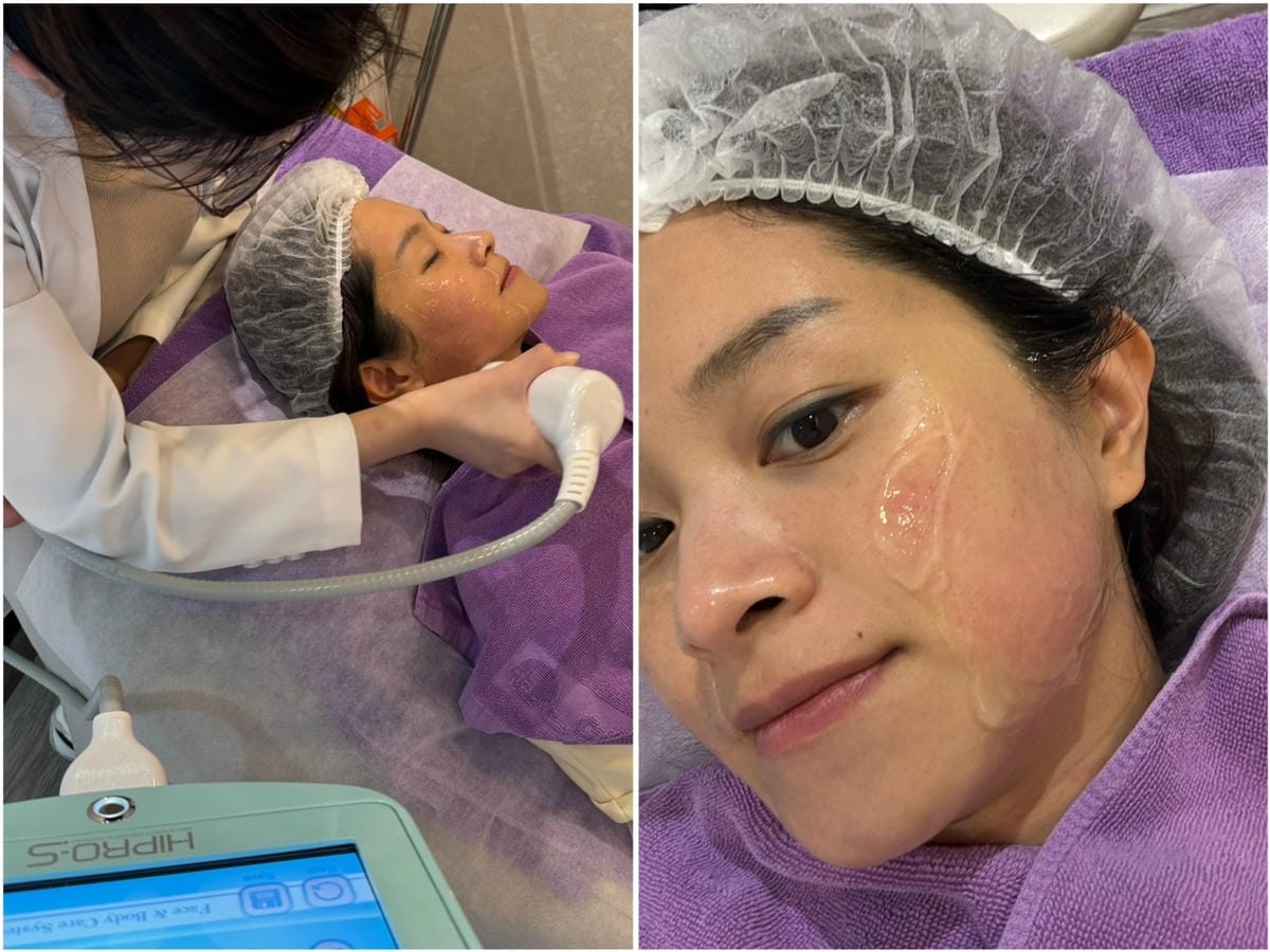 [美] 輕熟齡緊實拉提.ᐟ 愛爾麗診所 龍捲風音波拉提 無痛