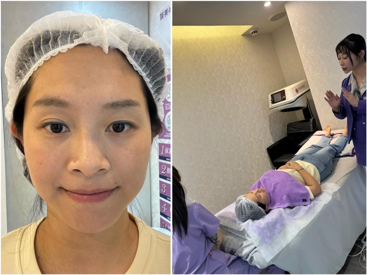 [美] 輕熟齡緊實拉提.ᐟ 愛爾麗診所 龍捲風音波拉提 無痛